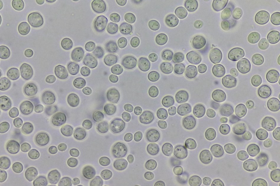 Saccharomyces cerevisiae под микроскопом